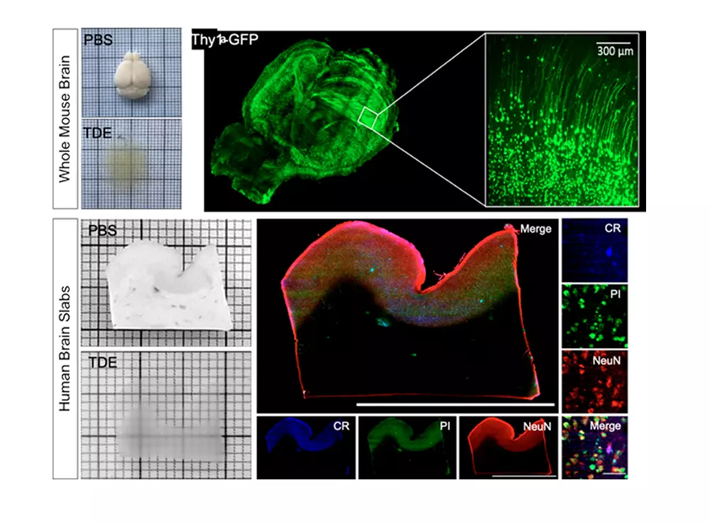 Large_volumetric_mapping_with_ligh_sheet_microscopy_mice_and_human_Irene_Costantini