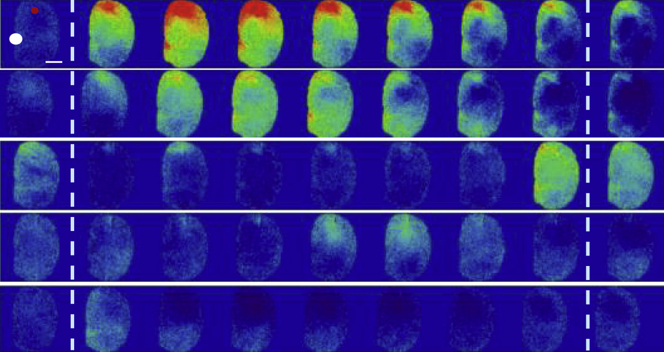 Light and Genetics to Explore Brain Connections