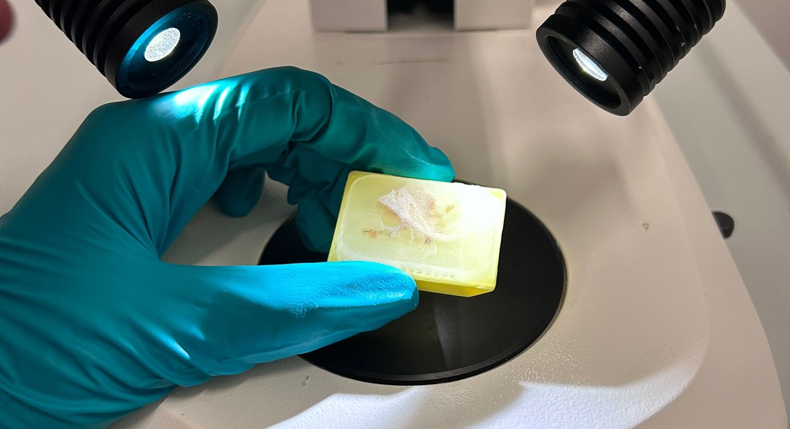 Cerebral Cold Cases: UNIFI Researchers Analyze the Cellular Structure of 10yr Old Brain Samples